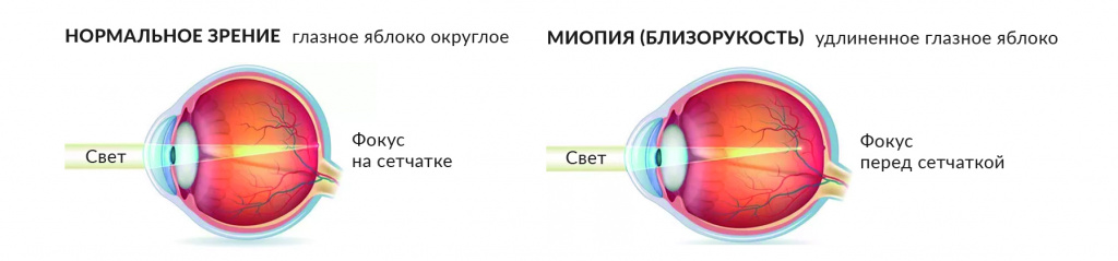 1периф.jpg