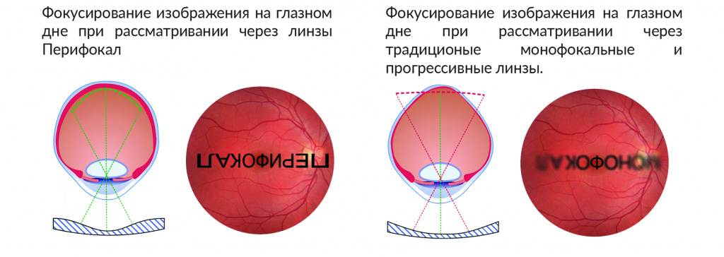 3периф.jpg